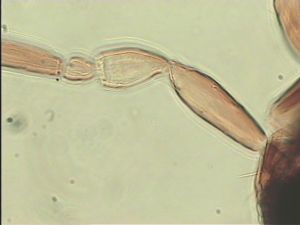 superaddita Htype 8.jpg