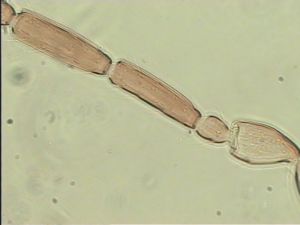 superaddita Htype 9.jpg