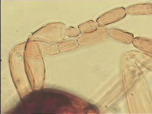 apilosa Htype  3.jpg