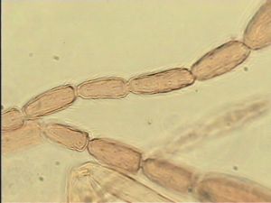 apilosa Htype  4.jpg