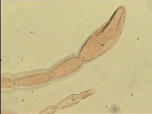 apilosa Htype  5.jpg