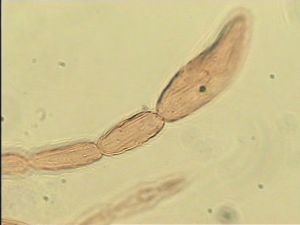 apilosa Htype  6.jpg