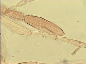 apilosa Htype  7.jpg