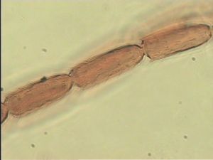 compressa Htype 10.jpg