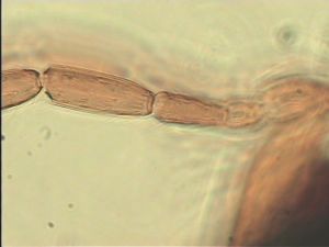 compressa Htype 12.jpg