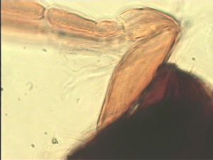 compressa Htype 4.jpg