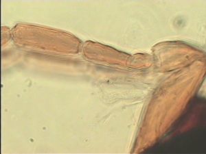 compressa Htype 5.jpg