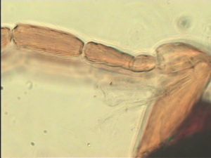 compressa Htype 6.jpg