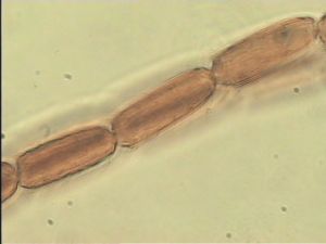 compressa Htype 7.jpg