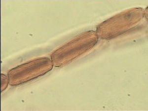 compressa Htype 8.jpg