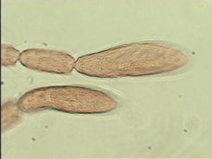 globosa Htype 10.jpg