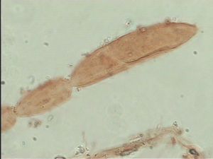 heterotomus Htype 13.jpg