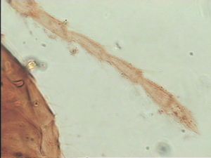 heterotomus Htype 14.jpg