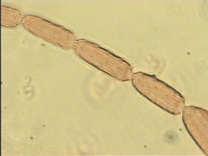 parciventris Htype 7.jpg