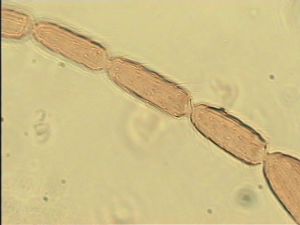 parciventris Htype 8.jpg