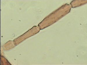 antoniae Htype 10.jpg