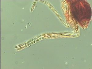 antoniae Htype 11.jpg