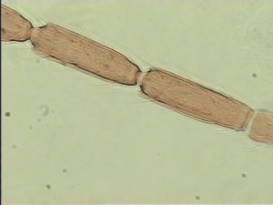 antoniae Htype 7.jpg