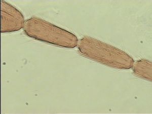 antoniae Htype 8.jpg