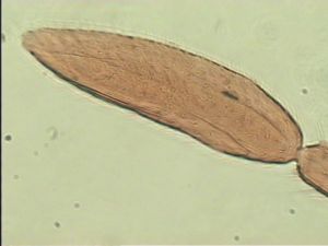 antoniae Htype 9.jpg