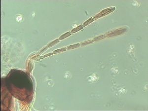 elegans Htype 5.jpg