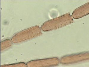 elegans Htype 8.jpg