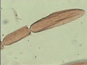 elegans Htype 9.jpg