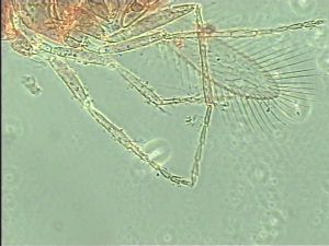 longispinosus Htype 11.jpg