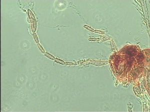 longispinosus Htype 4.jpg