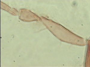 longispinosus Htype 5.jpg
