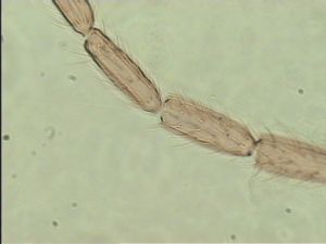 longispinosus Htype 7.jpg