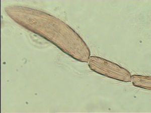 longispinosus Htype 8.jpg