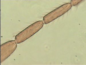 spinosus 'Type' 11.jpg