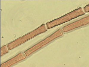 maculata Htype 12.jpg