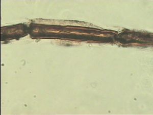 pratensis Ltype 9.jpg