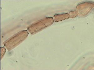 breviventris Htype 7.jpg