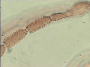 breviventris Htype 8.jpg