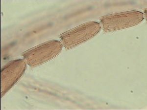 breviventris Htype 9.jpg