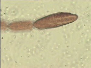 gauthieri Htype 9.jpg