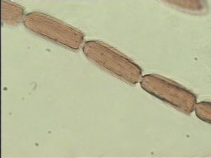 leonhardwitzi Htype 10.jpg