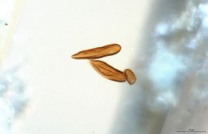 globosicornis Htype 0-7.jpg