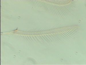 globosicornis Htype 7.jpg