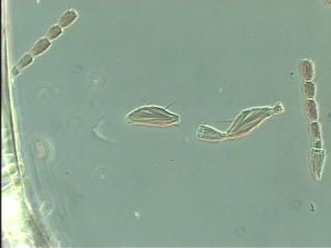 globosicornis Htype 9.jpg