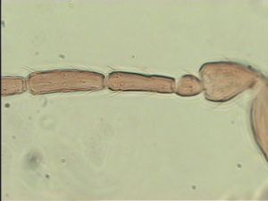 linearis Htype 5.jpg