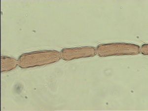 linearis Htype 6.jpg