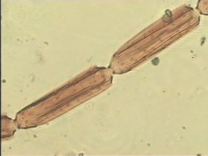 chrysomelae Atype 11.jpg