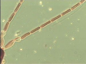 chrysomelae Atype 4.jpg