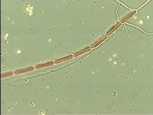 chrysomelae Atype 5.jpg