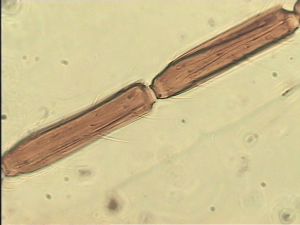 chrysomelae Atype 9.jpg