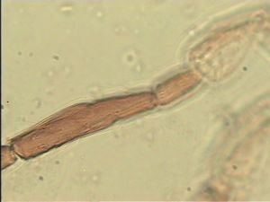 chrysomelae Htype 14.jpg